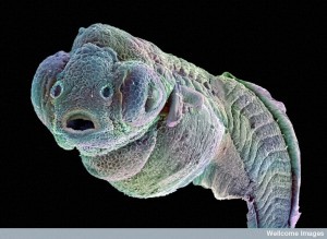 Zebrafish Embryo